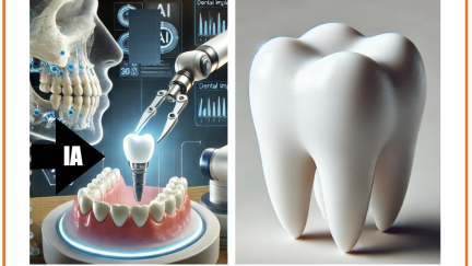 Aplicação da IA em implantologia dentária  atualmente  e previsõe para o futuro