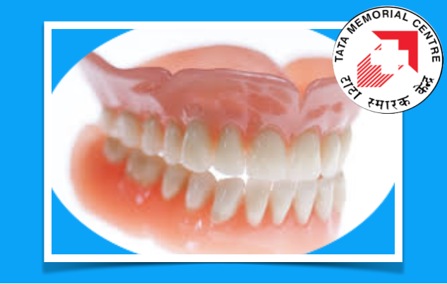 Próteses dentárias deficientes podem ser um fator de risco de cancro oral