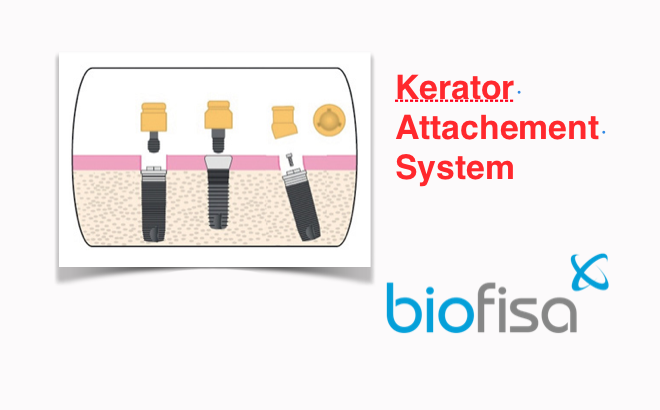 Biofisa distribuidor exclusivo da Kerator Attachment System